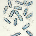 Untitled (E. coli)
